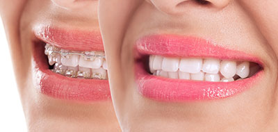 The image shows a person with two lips, each displaying a different shade of lipstick, placed side by side against a neutral background.