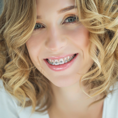 The image shows a smiling woman with blonde hair, wearing braces, and posing for a portrait against a white background.